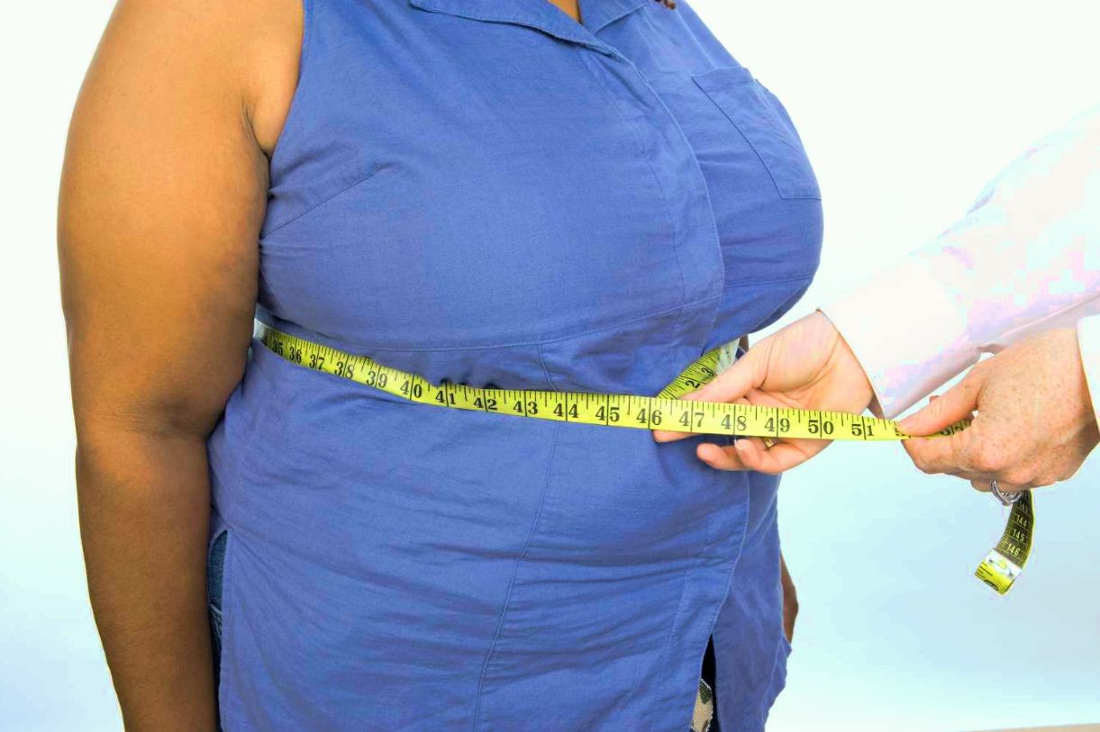 Гипоталамическое ожирение: причины, признаки, лечение